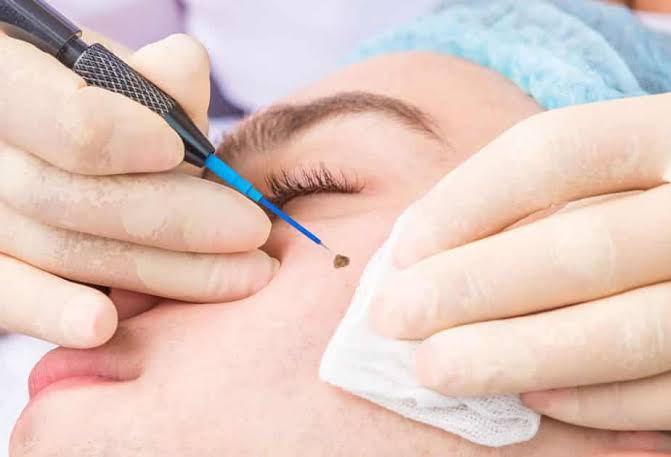 Hair Loss Doctor in Udupi